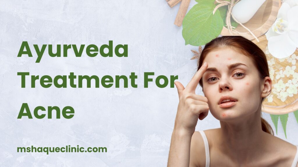 Ayurveda Treatment For Acne : Types , Causes And Treatment - Mshaque