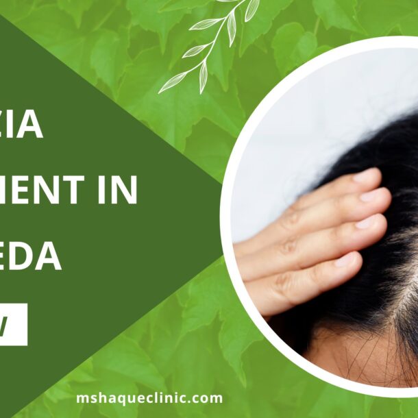 Alopecia treatment in Ayurveda