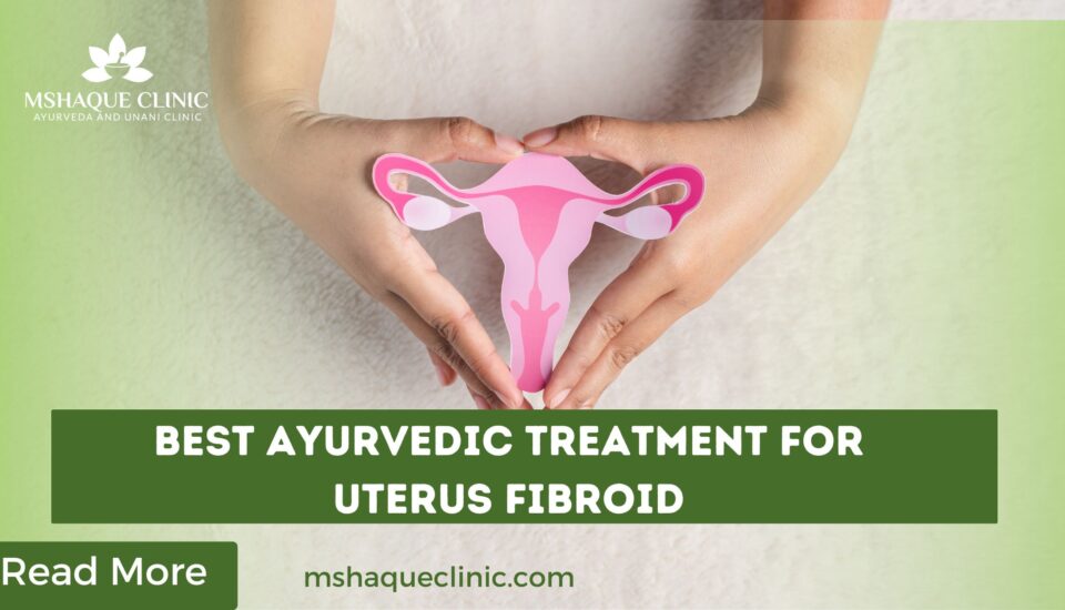 Best Ayurvedic Treatment For Uterus Fibroid