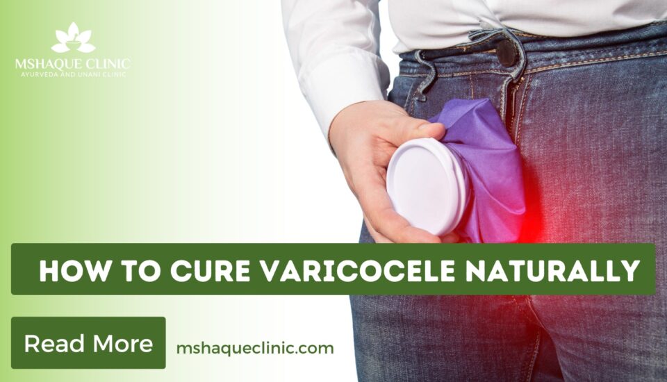 How To Cure Varicocele Naturally