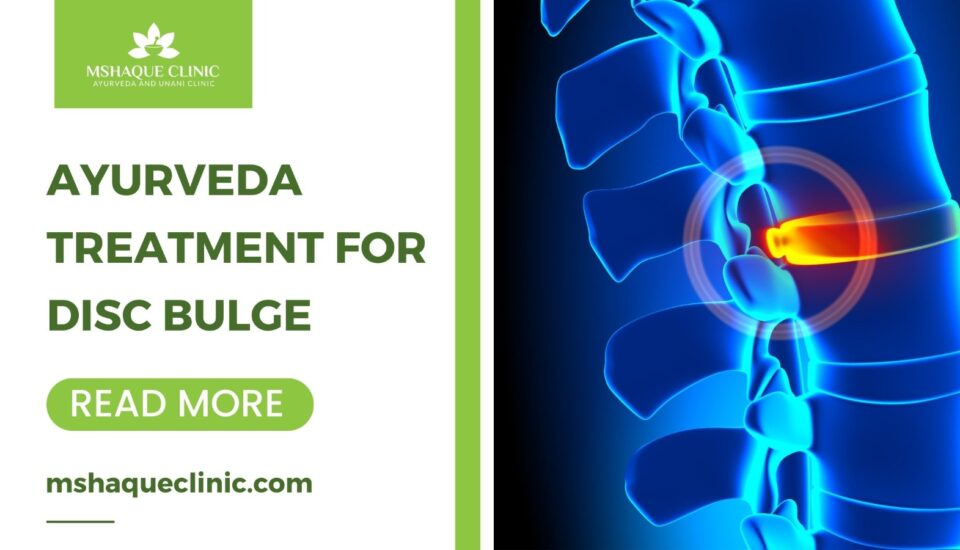 Remove term: Ayurveda Treatment For Disc Bulge Ayurveda Treatment For Disc Bulge