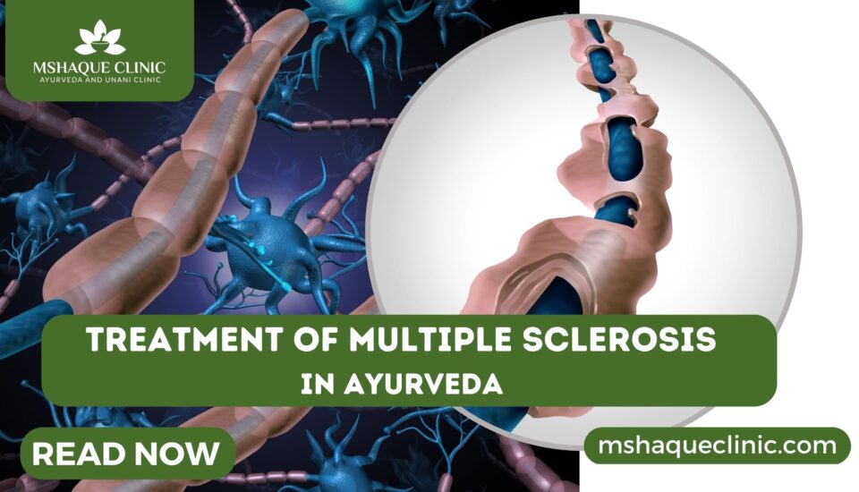 Treatment Of Multiple Sclerosis In Ayurveda