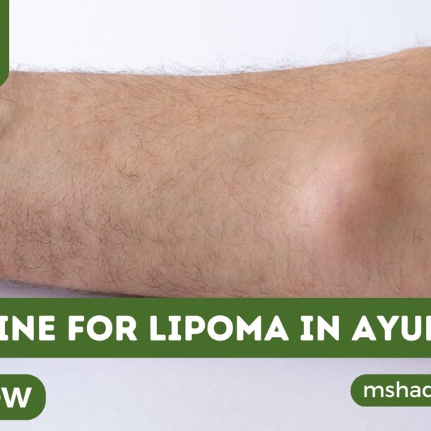 Medicine For Lipoma In Ayurveda