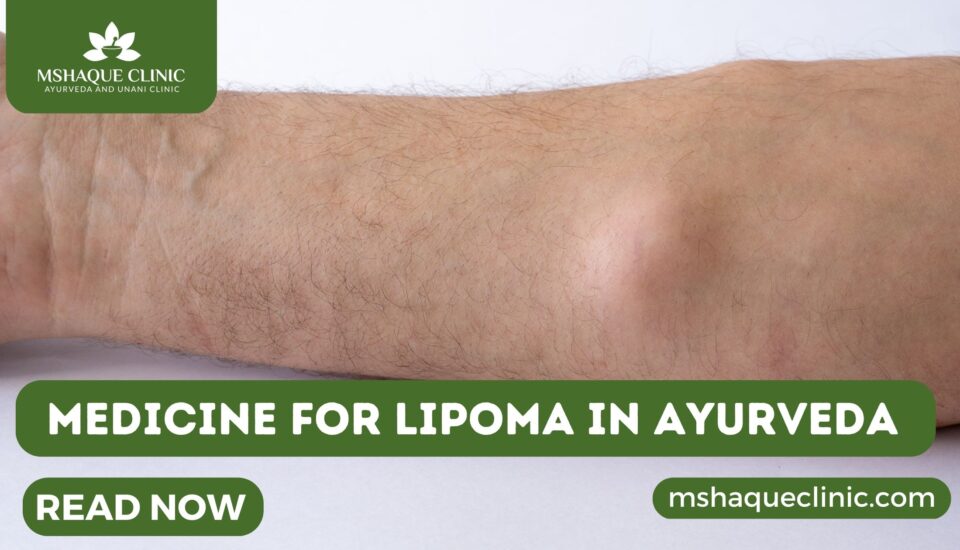 Medicine For Lipoma In Ayurveda