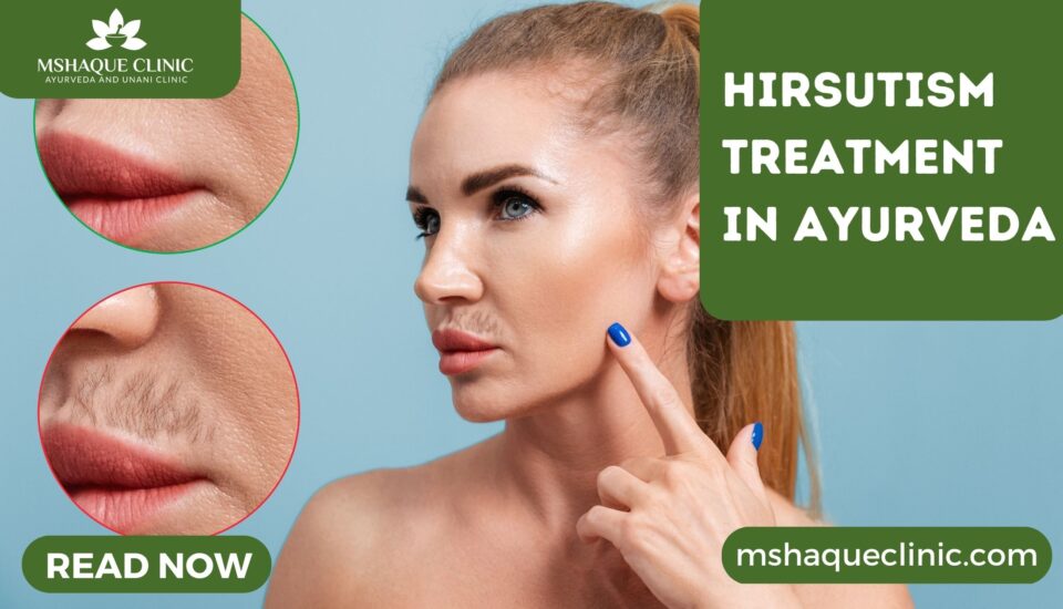 Hirsutism Treatment In Ayurveda