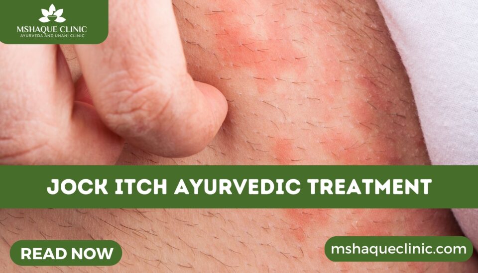 Jock Itch Ayurvedic Treatment