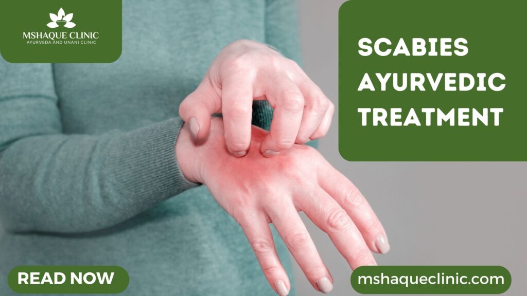 Scabies Ayurvedic Treatment
