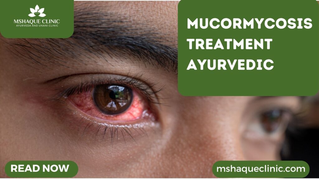 Mucormycosis Treatment Ayurvedic- All You Need To Know