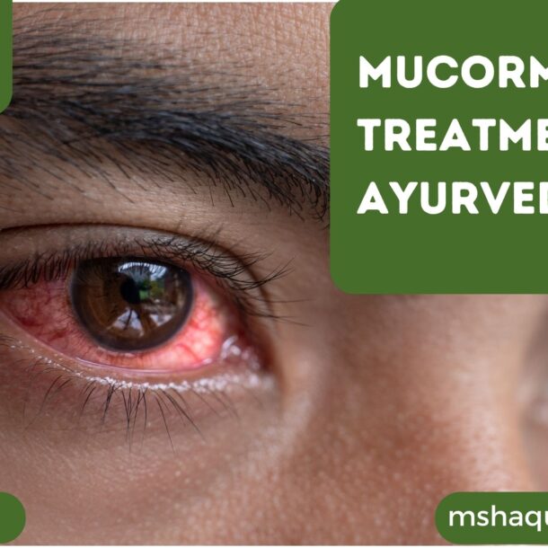 Mucormycosis Treatment Ayurvedic
