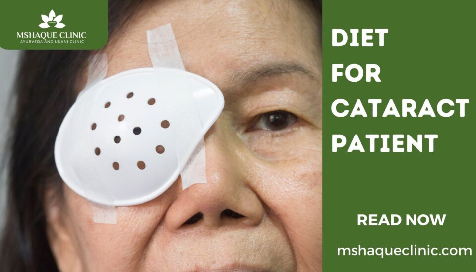 Diet For Cataract Patient