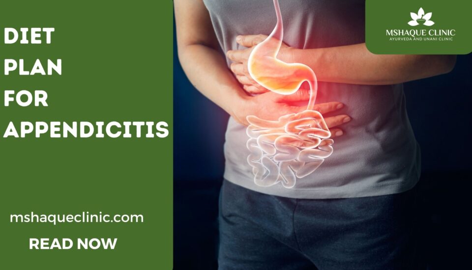 Diet Plan For Appendicitis