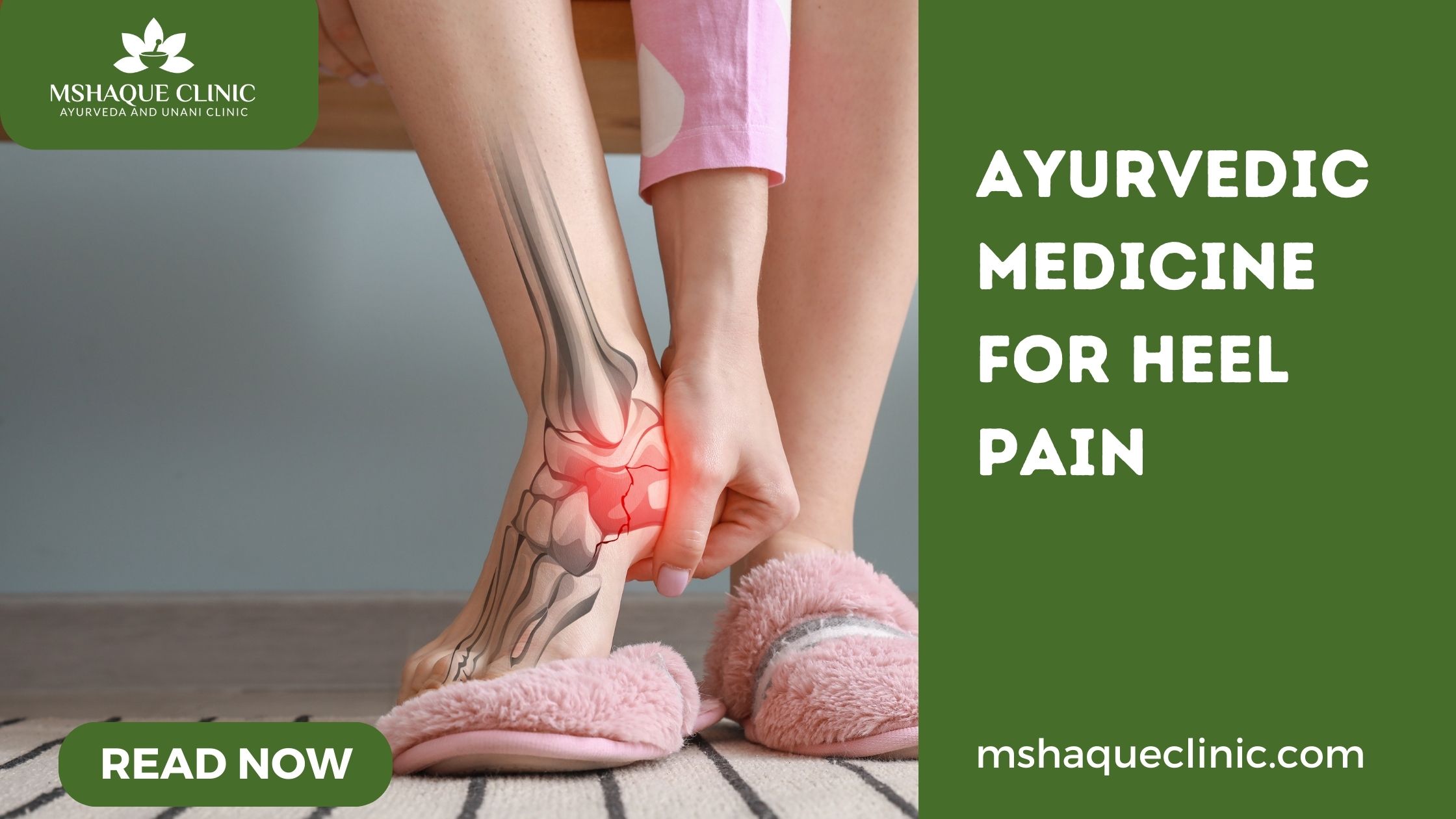 Ayurvedic treatment store for heel pain