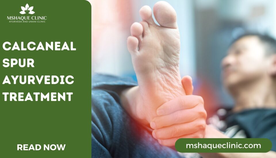 Calcaneal Spur Ayurvedic Treatment