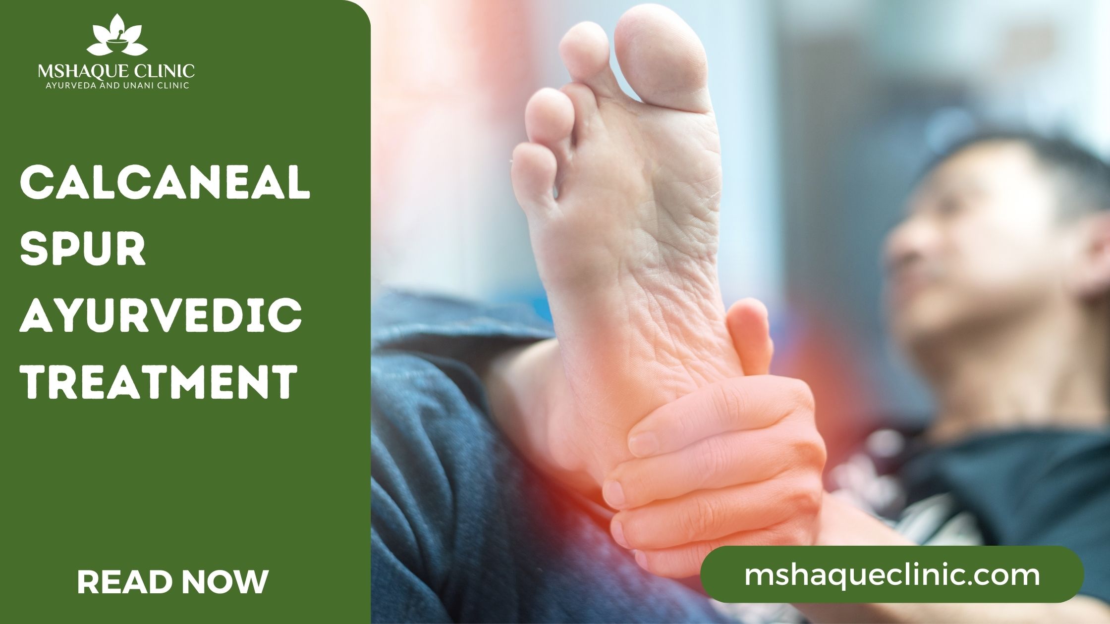 Calcaneal Spur A calcaneal spur, or commonly known as a heel spur, occurs  when a bony outgrowth forms on the heel bone. Calcaneal spurs can be  located at the back of the
