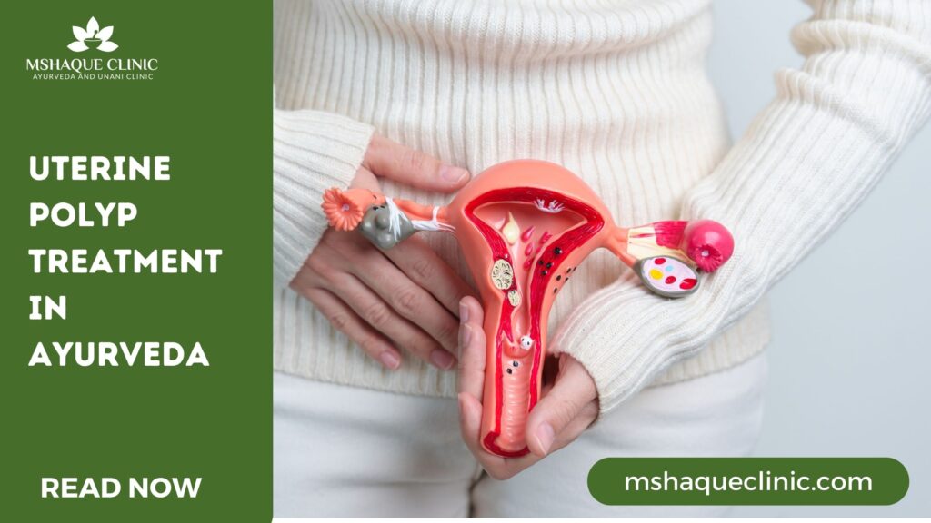 Uterine Polyp Treatment In Ayurveda