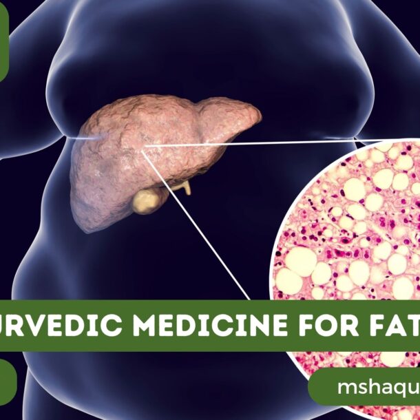 Best Ayurvedic Medicine For Fatty Liver