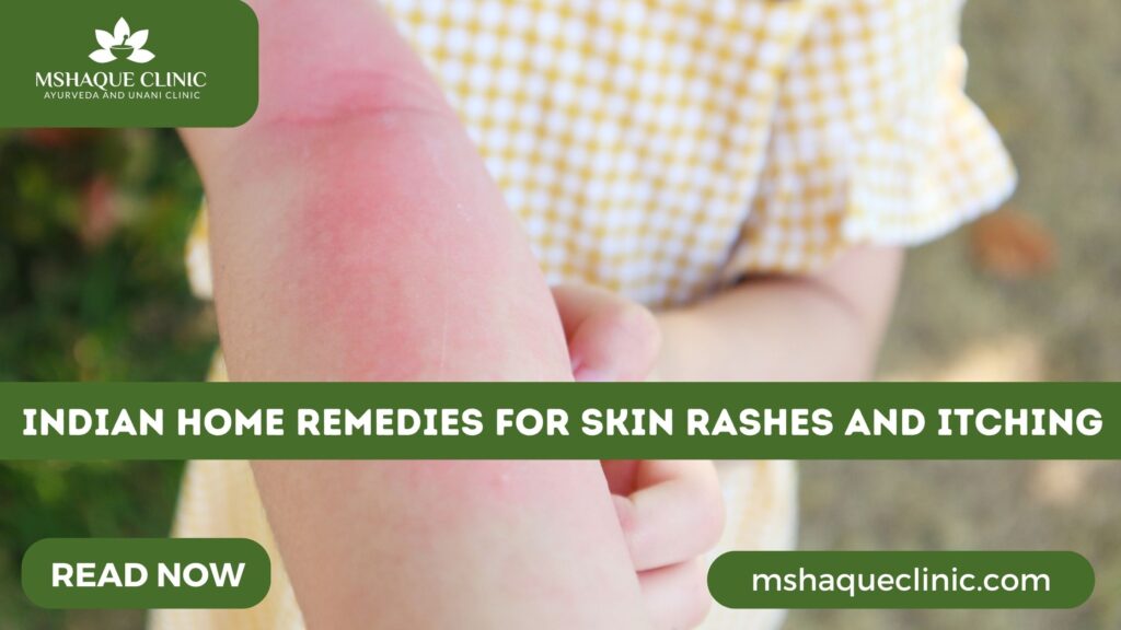 indian-home-remedies-for-skin-rashes-and-itching-all-you-need-to-know