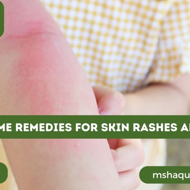 Indian Home Remedies For Skin Rashes And Itching