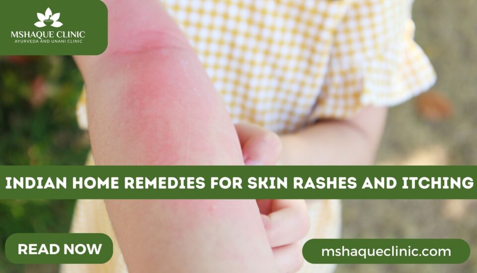 Indian Home Remedies For Skin Rashes And Itching