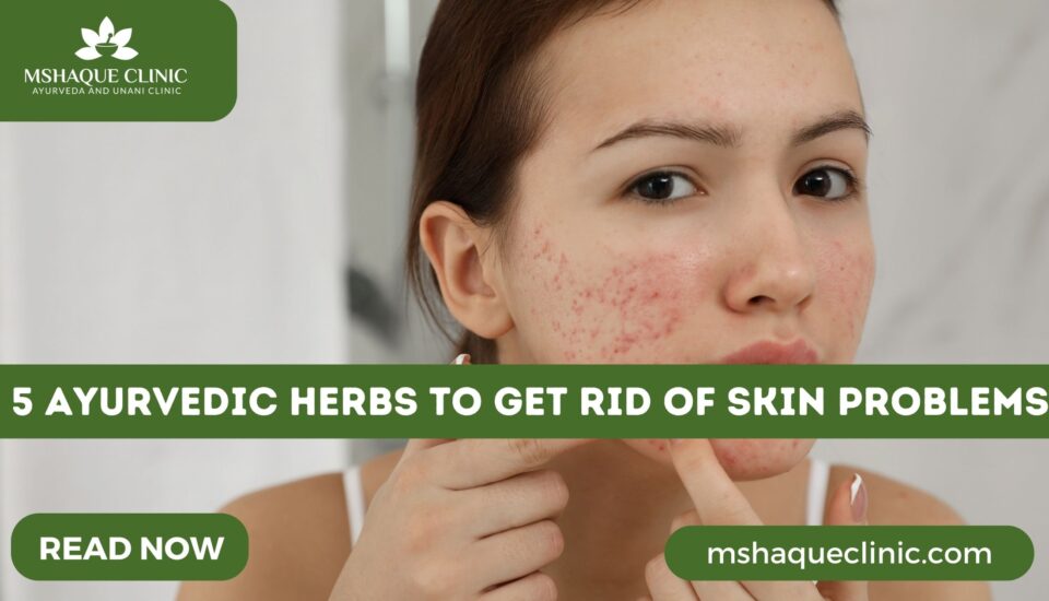 5 Ayurvedic Herbs To Get Rid Of Skin Problems