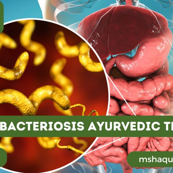 Campylobacteriosis Ayurvedic Treatment