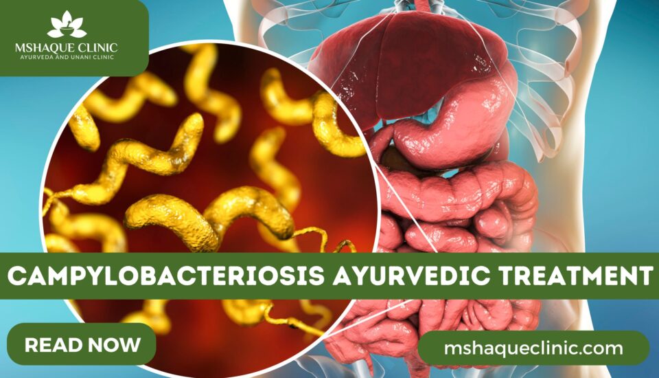 Campylobacteriosis Ayurvedic Treatment