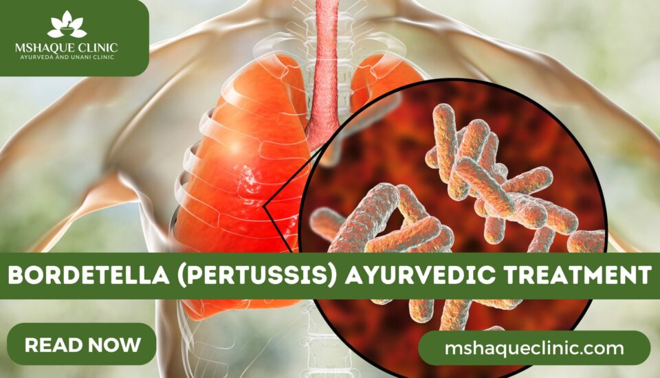 Bordetella (Pertussis) Ayurvedic Treatment