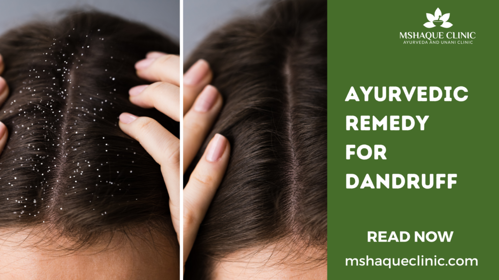 Ayurvedic Remedy For Dandruff