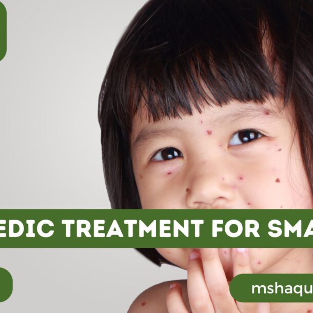 Ayurvedic Treatment For Smallpox