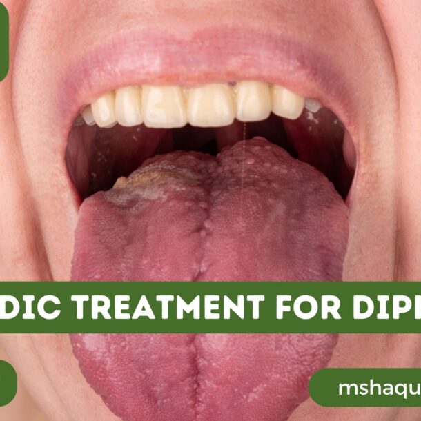 Ayurvedic Treatment For Diphtheria