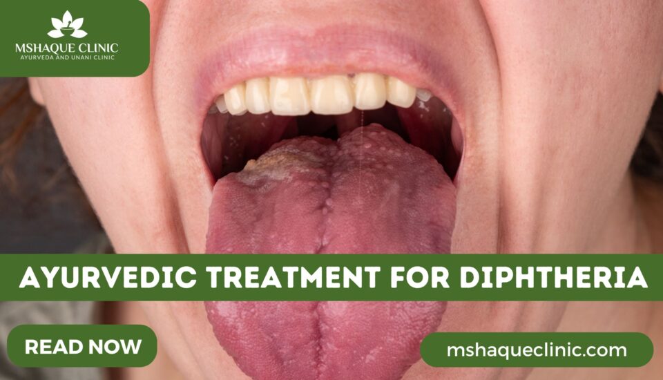 Ayurvedic Treatment For Diphtheria