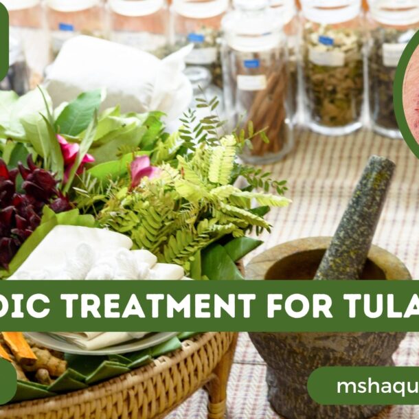 Ayurvedic Treatment For Tularaemia