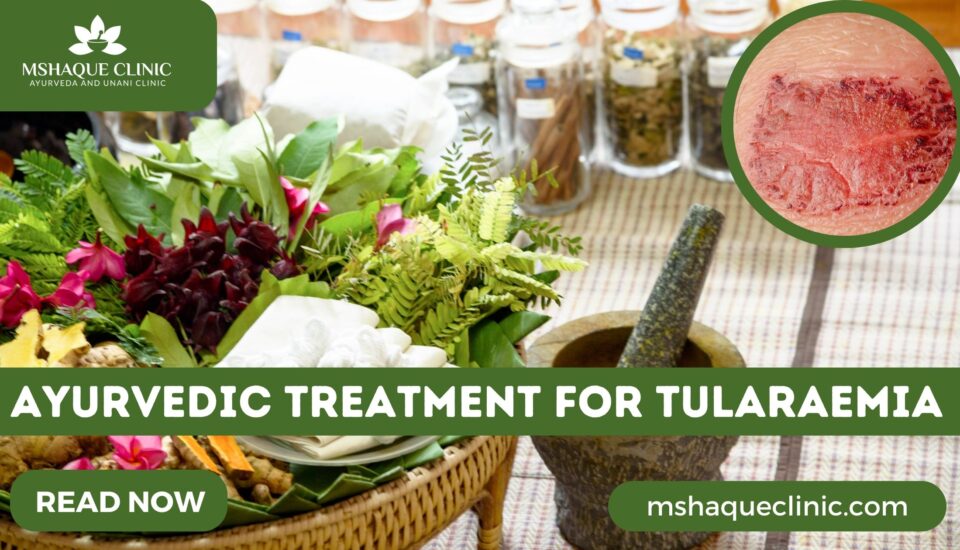 Ayurvedic Treatment For Tularaemia