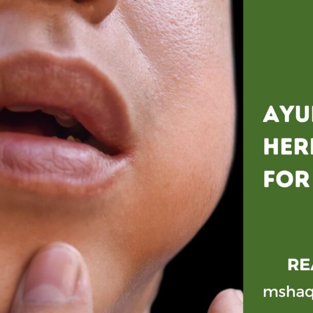 Ayurvedic Herbs For Mumps