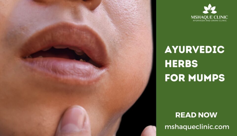 Ayurvedic Herbs For Mumps