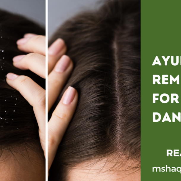 Ayurvedic Remedy For Dandruff