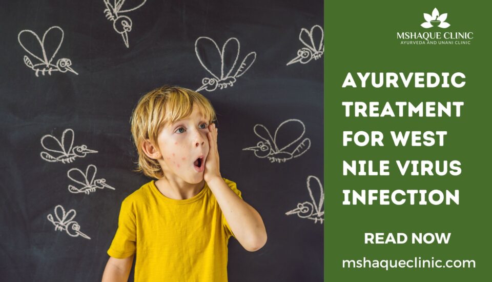 Ayurvedic Treatment For West Nile Virus Infection