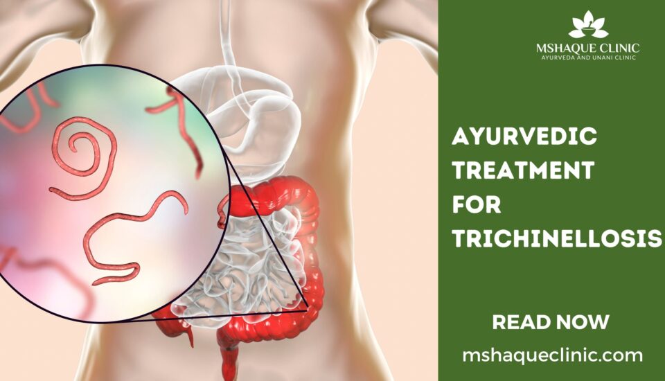 Ayurvedic Treatment For Trichinellosis