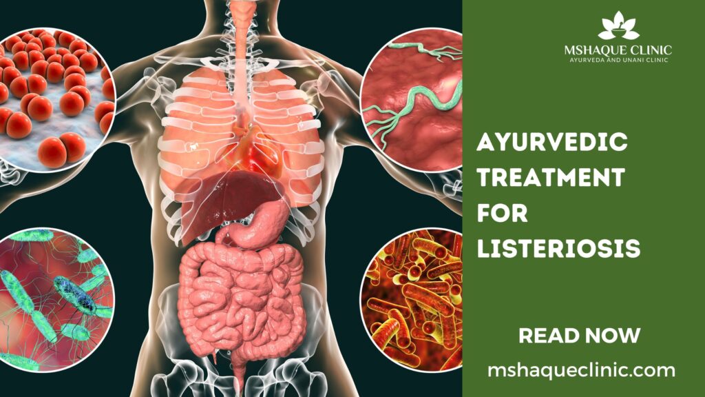 Ayurvedic Treatment For Listeriosis