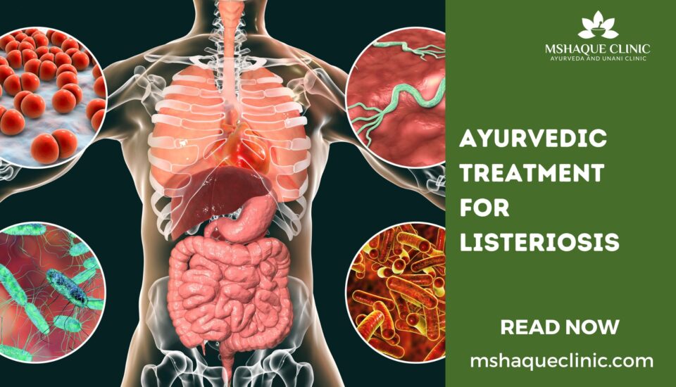 Ayurvedic Treatment For Listeriosis