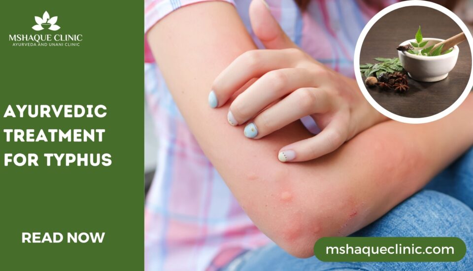 Ayurvedic Treatment For Typhus