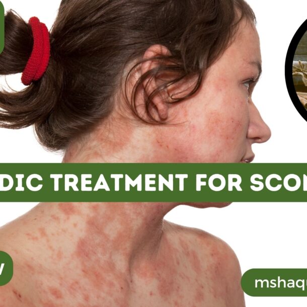 Ayurvedic Treatment For Scombroid