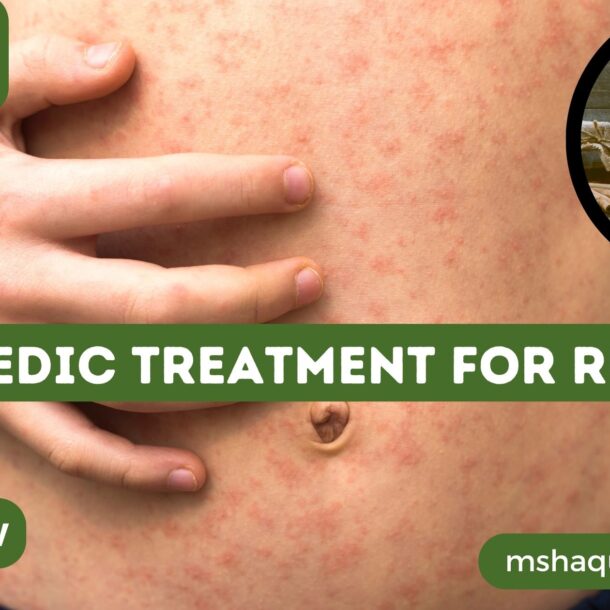 Ayurvedic Treatment For Rubella