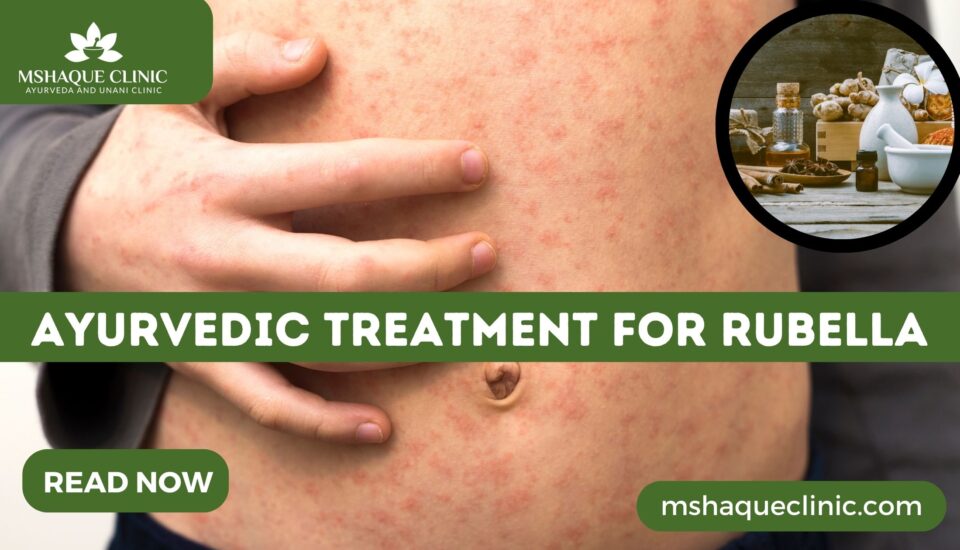 Ayurvedic Treatment For Rubella