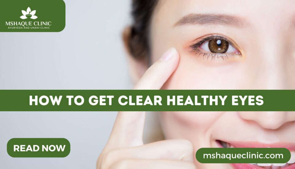 How To Get Clear Healthy Eyes