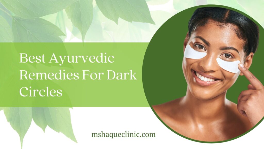 Best Ayurvedic Remedies For Dark Circles