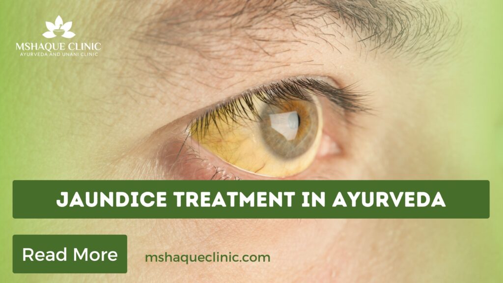 Jaundice Treatment In Ayurveda