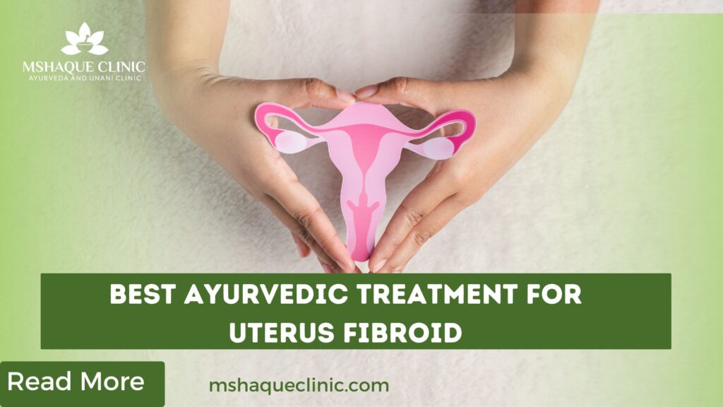 Best Ayurvedic Treatment For Uterus Fibroid