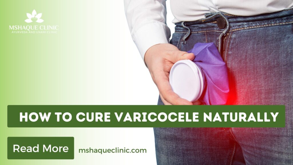 How To Cure Varicocele Naturally