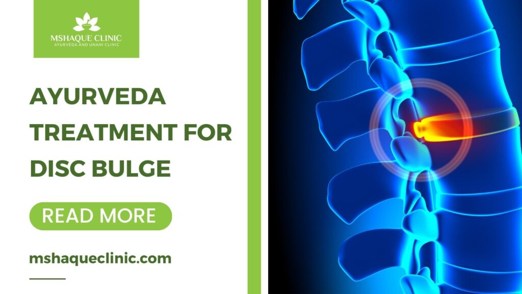 Remove term: Ayurveda Treatment For Disc Bulge Ayurveda Treatment For Disc Bulge